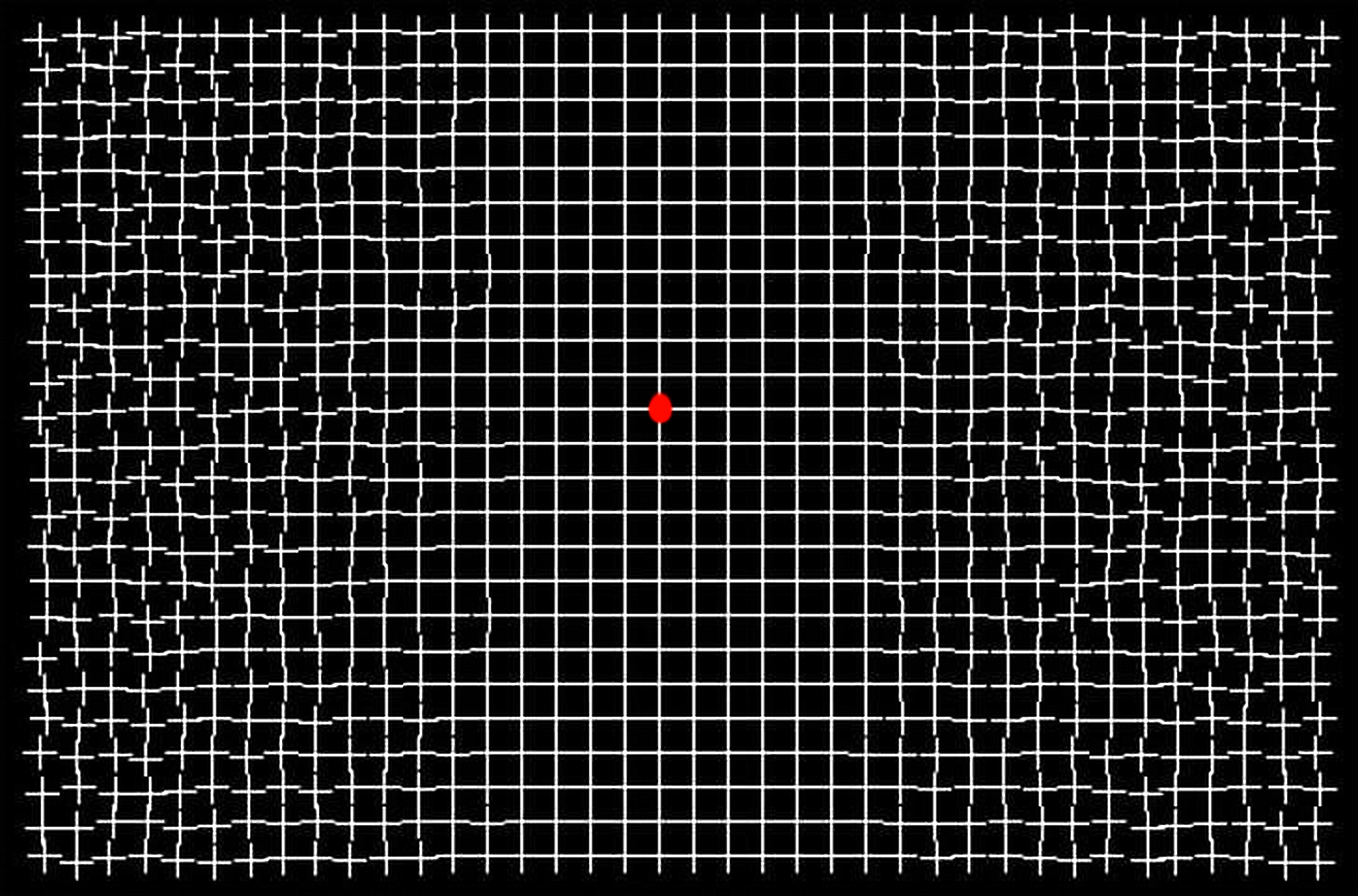 DOTT. EMILIO ALESSIO LOIACONO MEDICO CHIRURGO DIRETTORE MEDICINA ONLINE EFFETTO OTTICO RETE DISTORTA LINEE BIANCHE PUNTINO ROSSO NEL MEZZO