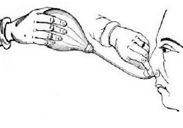 MEDICINA ONLINE EMILIO ALESSIO LOIACONO MANOVRA DI POLITZER COMPENSAZIONE FORZATA ORECCHIO MEDIO PRESSIONA ORECCHIO TAPPATO SUBAQUEO AEROPLANO AEREO OTORINOLARINGOIATRIA